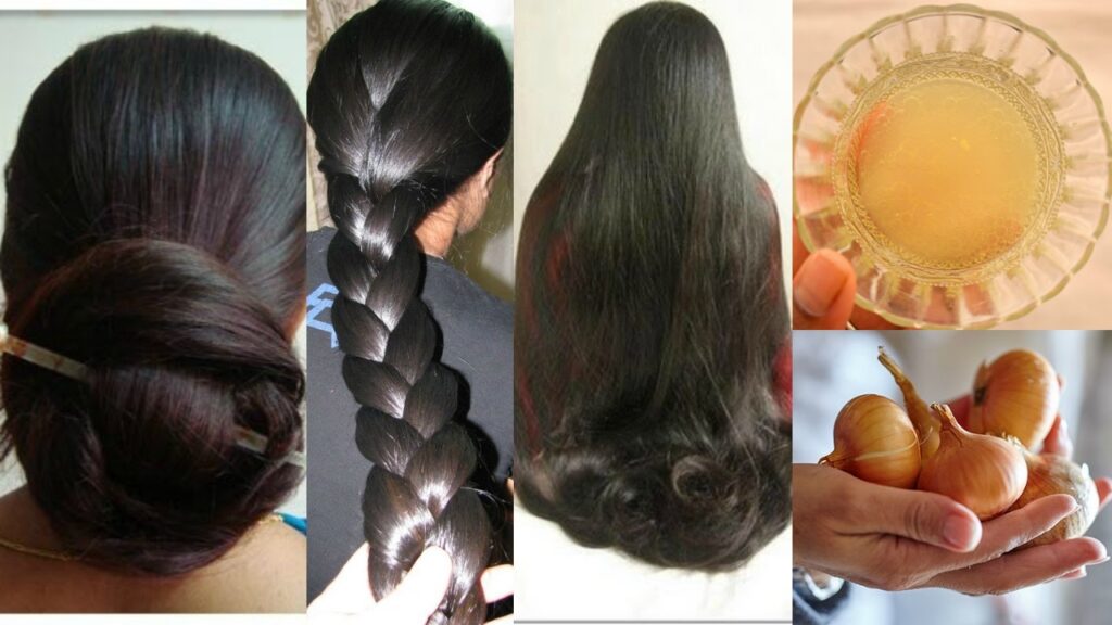 Home Remedies And Tips To Prevent Excessive Hair Fall In Rainy Season